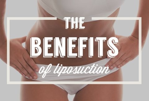 specialist about liposuction