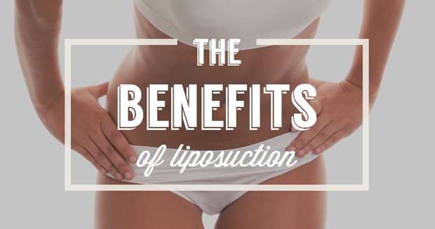 specialist about liposuction