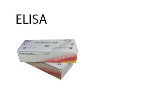 Here Is Why You Need To Trust Elisa Test