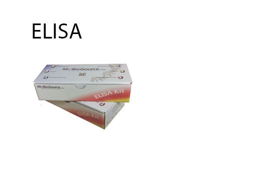 Here Is Why You Need To Trust Elisa Test