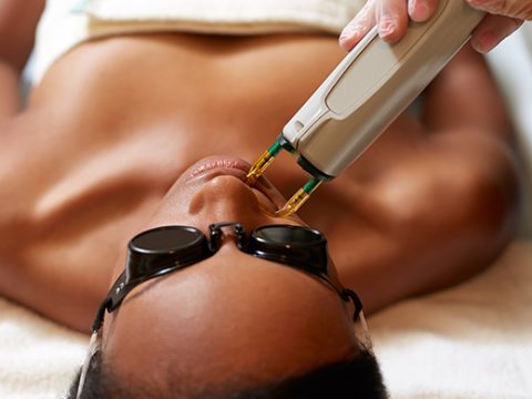 Questions About Laser Treatments? Learn The Basics