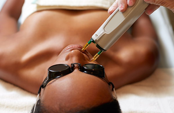 Questions About Laser Treatments? Learn The Basics