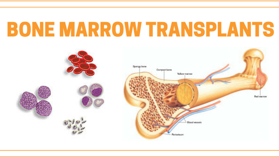 Benefits Of A Bone Marrow Transplant In India